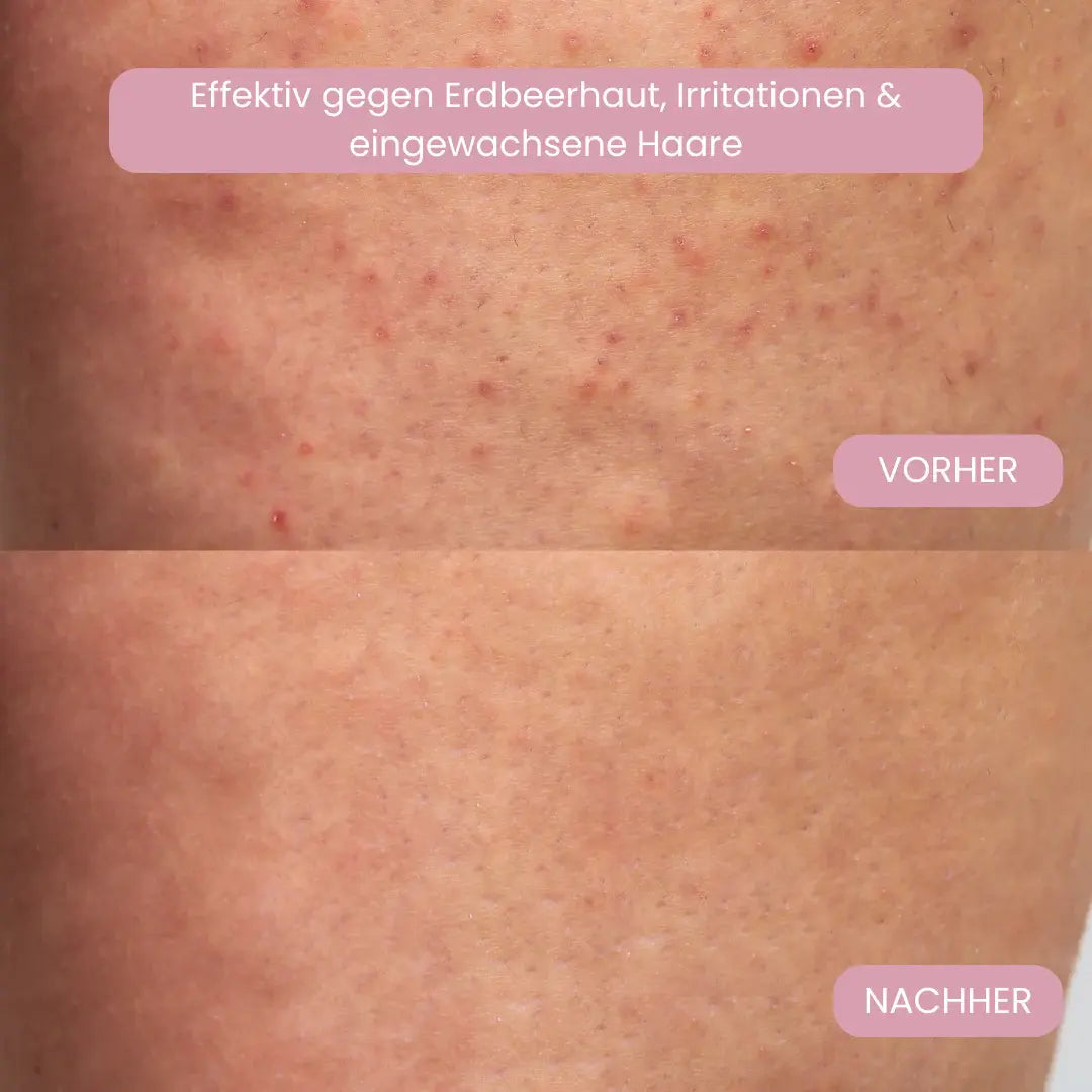 Glisse Pro Frühlings Starter Set
